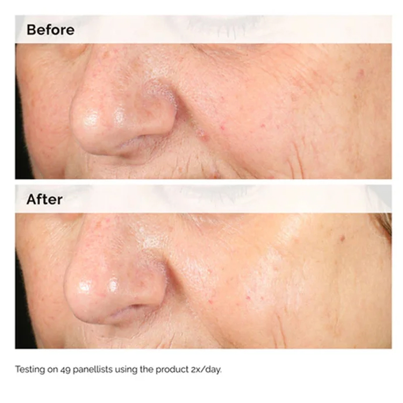 Alpha Arbutin 2% + HA 30ml Ser - Alpha Arbutin Serum 评论和价格